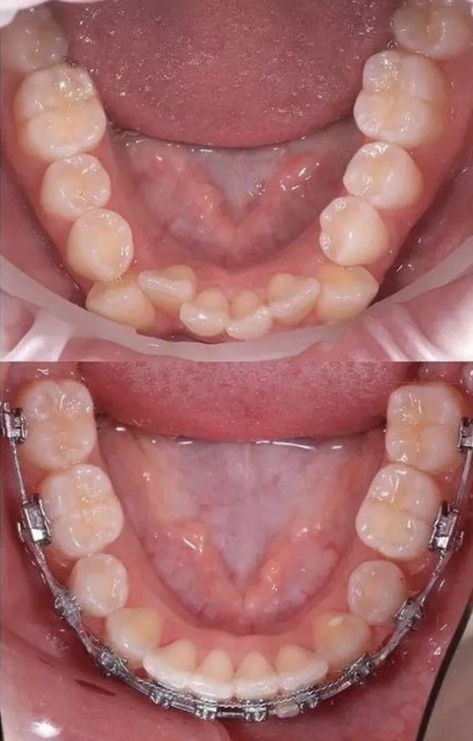 Antes e Depois 5