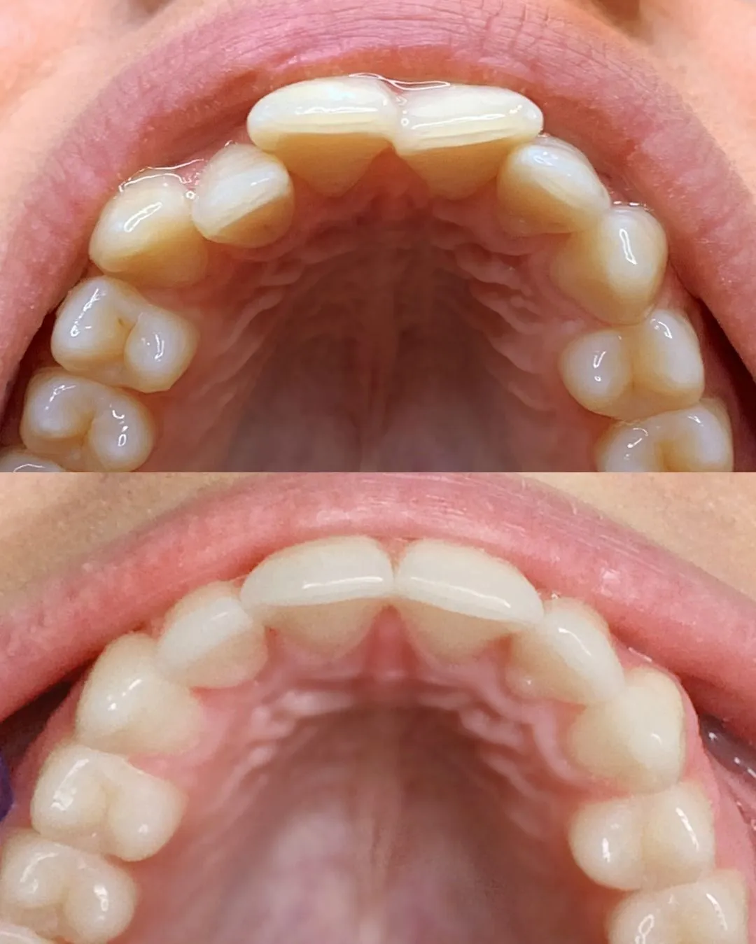 Antes e Depois 6