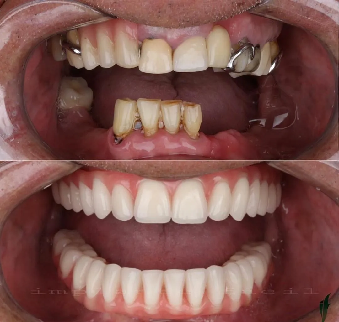 Antes e Depois 8